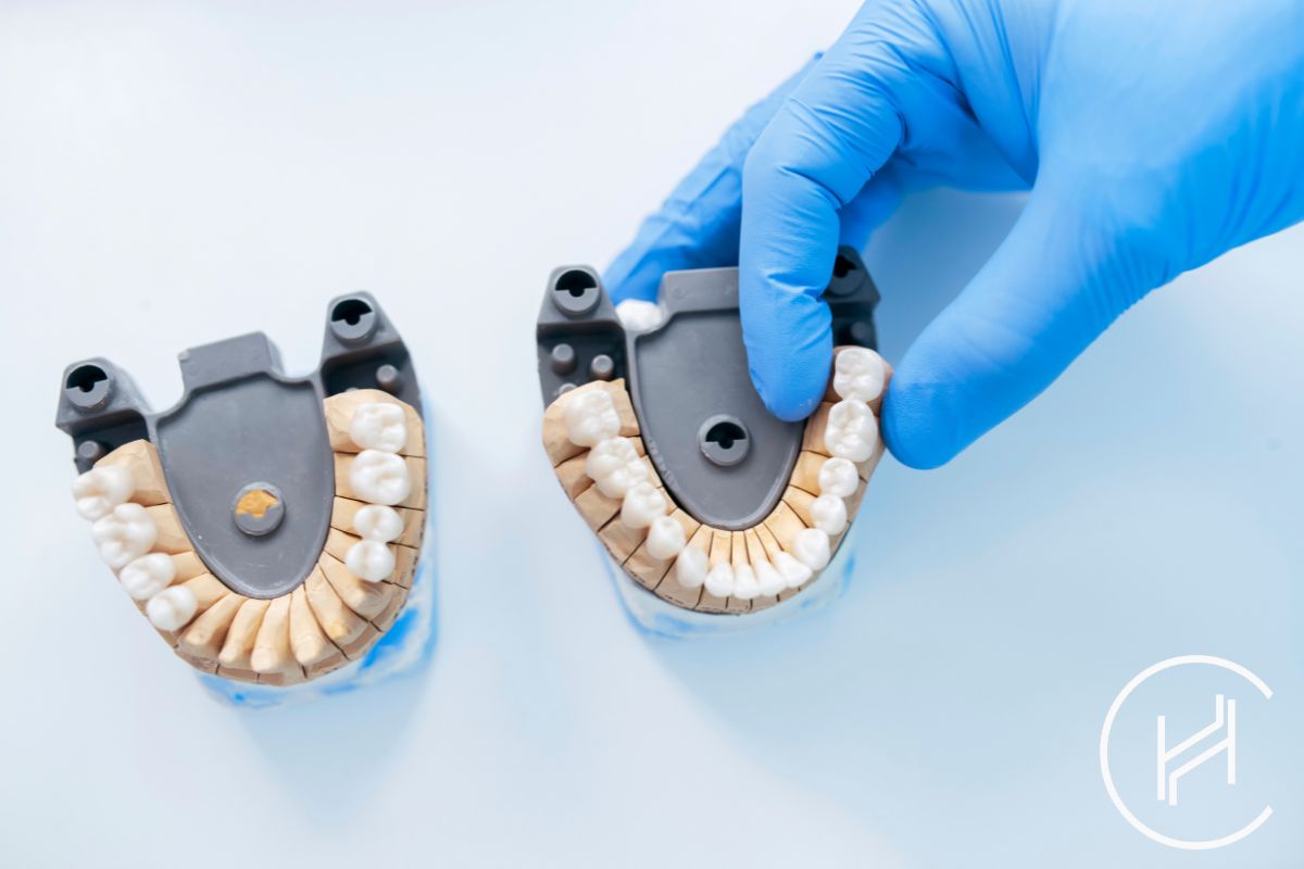 Dental Bridge Treatment In Turkey Procedure And Costs Heva Clinic