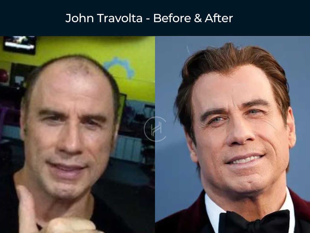 john travolta then and now