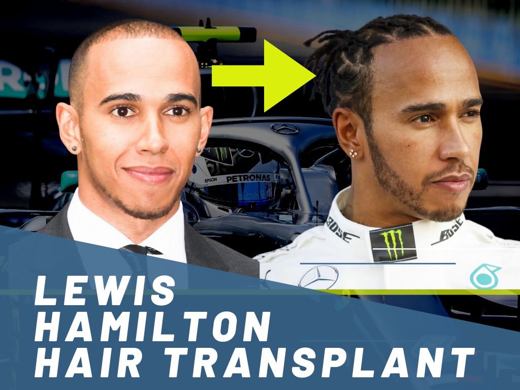 Lewis Hamilton: Braided Hairstyle