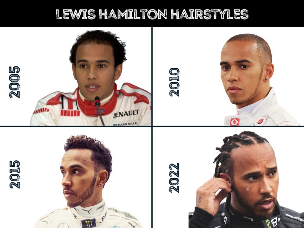 Has Lewis Hamilton Had A Hair Transplant  An Experts Opinion  Man For  Himself