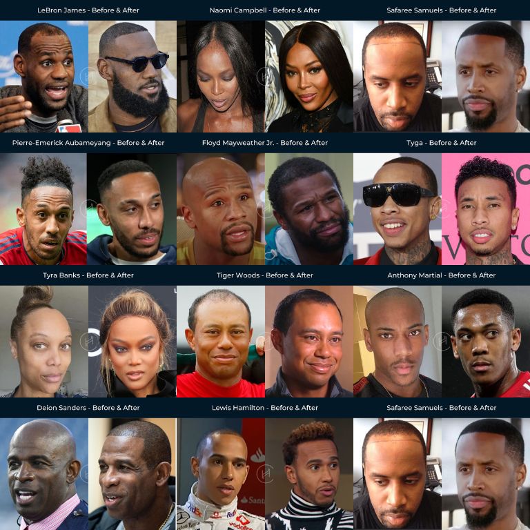 Bald haircuts for black men  Afroculturenet