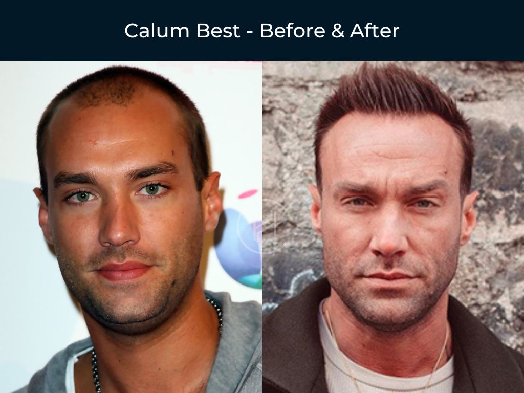 male celebrity before and after weight loss