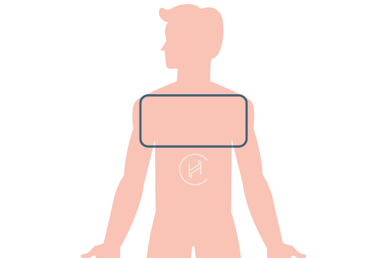 Body Hair to Head Transplant in Turkey (Chest, Beard, Leg, Armpit)