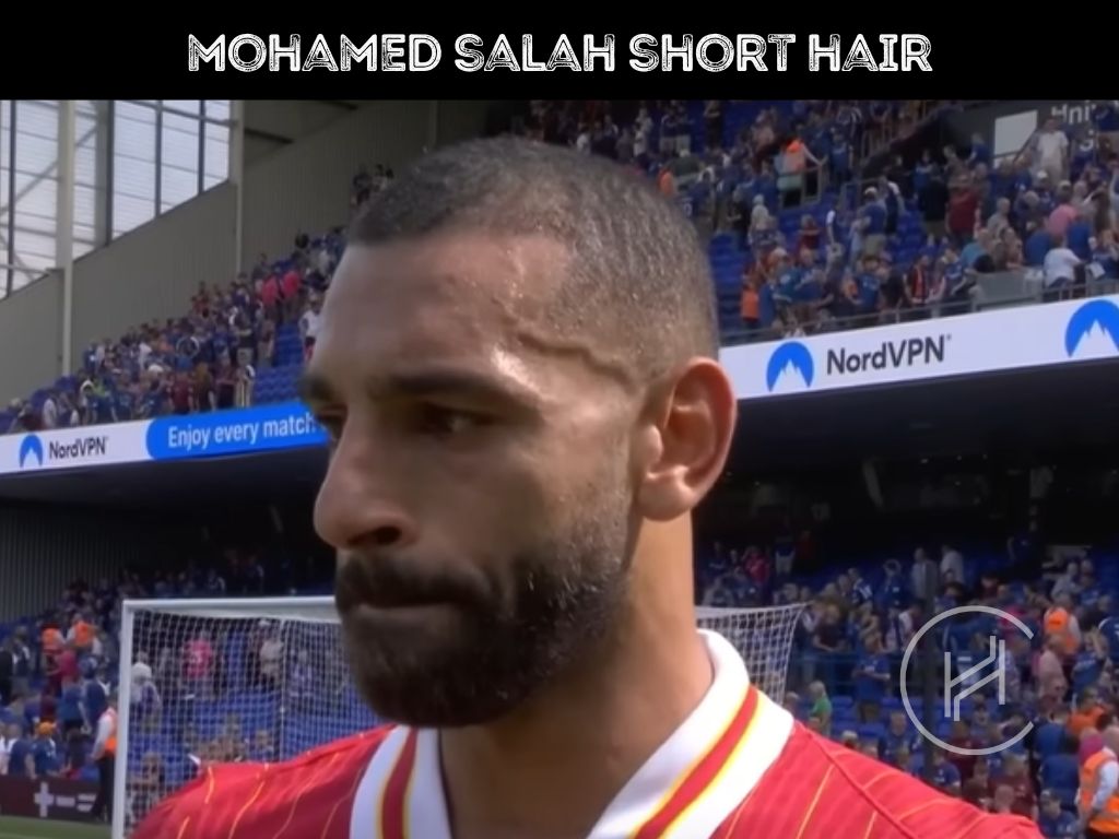 Mo Salah Hair Transplant - Hair Loss & Technical Analysis