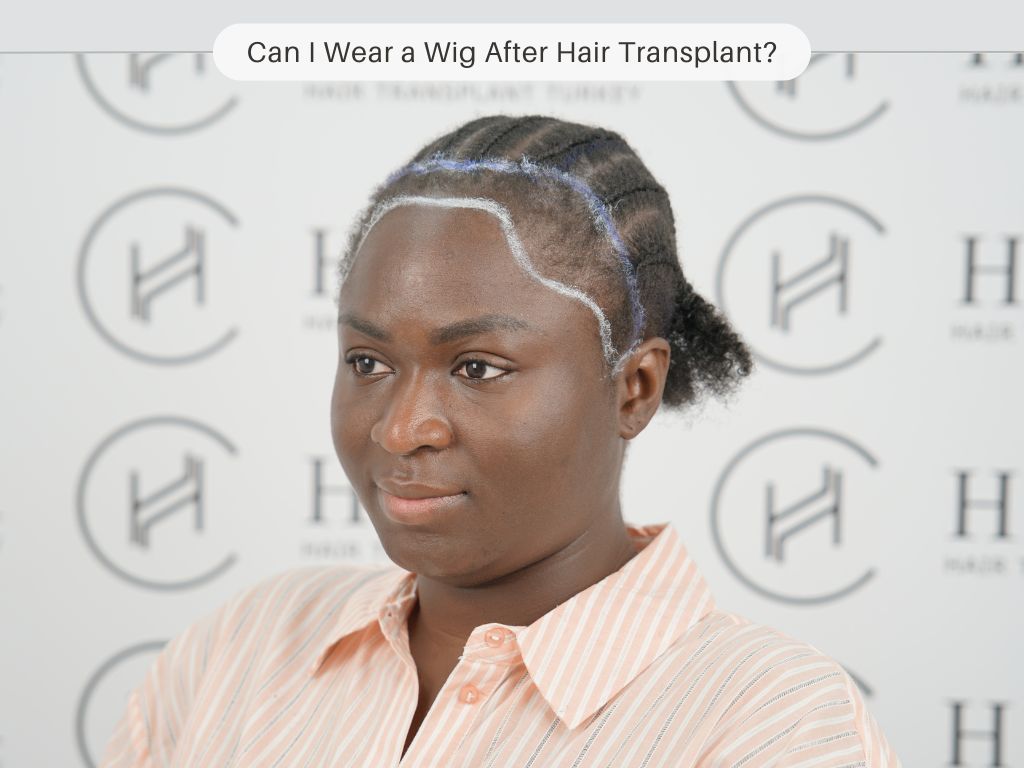 Can I Wear a Wig After Hair Transplant Tips After Hair Transplant